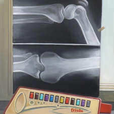 "Röntgenbild und Triola" | 2005| Öl auf Lw | 40 x 30 | Sven Großkreutz